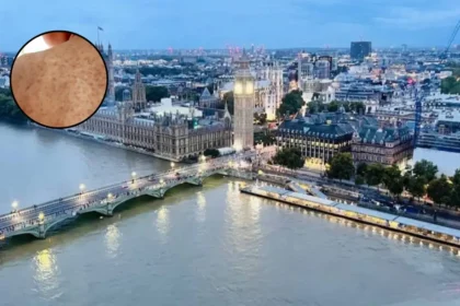 Alicante Measles Hits North London—Travel Chaos 2026