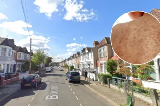 Eleven Measles Cases Confirmed in Haringey Amid North London Outbreak 2026