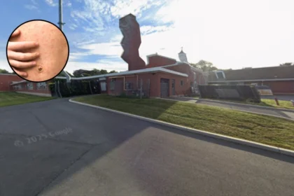 Measles Hits Enfield Schools, Low Jab Boroughs North London 2026