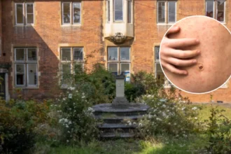 Measles Outbreak Hits Enfield Schools, 60+ Children Infected 2026