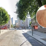 North London Measles Outbreak: GPs Warn of Worse Crisis 2026