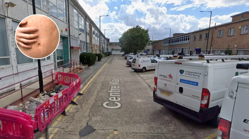 Enfield Tops London's Measles Cases with Low Vaccination Rates 2026