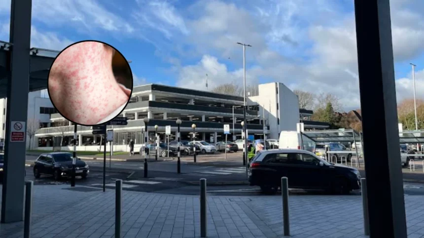 Enfield Measles Outbreak Hits Schools, Reveals Low-Vax London Boroughs 2026